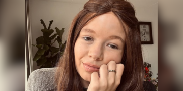 ongeneeslijk zieke Jade Kops